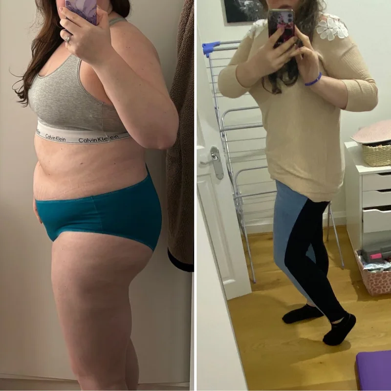 Emma: before on the left, after on the right