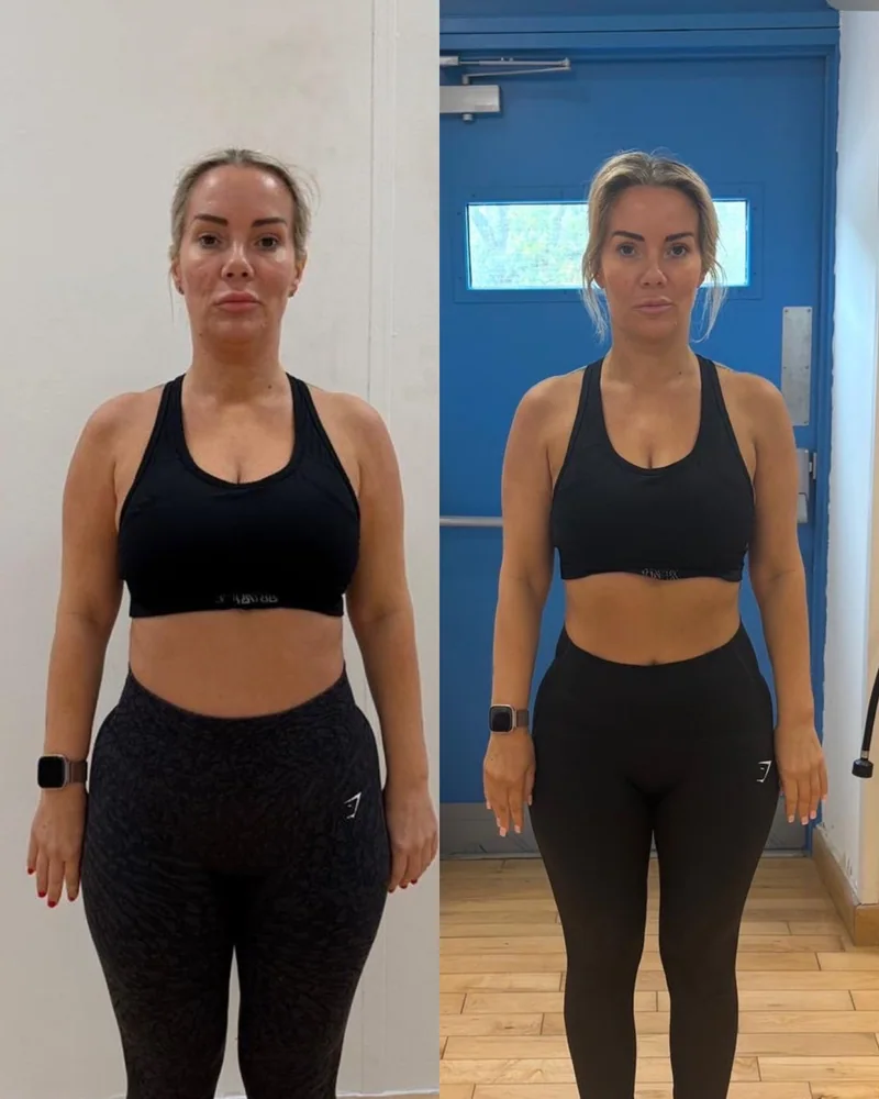 Kate R.: before on the left, after on the right